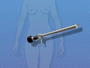 A laparoscope is a narrow tube
