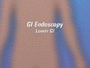Your doctor has recommended that you have a lower GI endoscopy. But what does that actually mean?