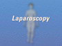 Your doctor believes that your medical condition and overall state of health make you a good candidate for less intrusive laparoscopic surgery.