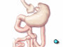 The main part of the intestine is pulled upward, behind the colon and positioned near the small upper stomach pouch.
