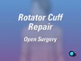 The choice of treatment for a torn rotator cuff depends on kind of damage that has occurred as well as the state of your health and the condition of the rotator cuff tendons themselves.